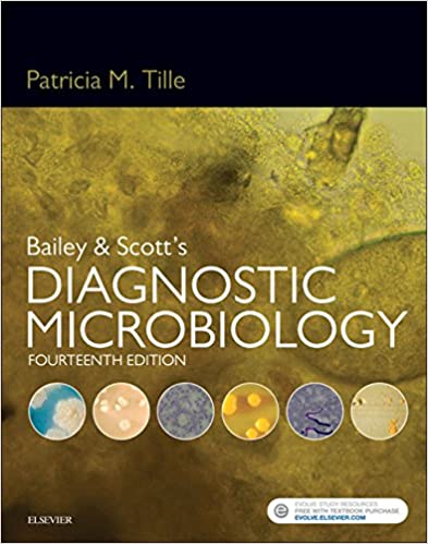 Bailey & Scott's Diagnostic Microbiology, 14th Edition by Patricia Tille 2015 Test Bank ( Mosby publsiehr )